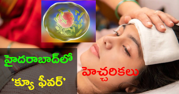 హైదరాబాద్‌లో కొత్త రకం జ్వరం.. క్యూ ఫీవర్ అలర్ట్